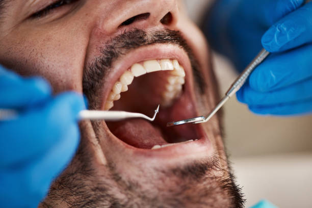 Best After-Hours Dental Care in Panthersville, GA